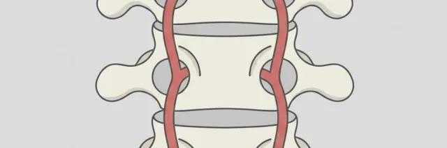 A simplified anatomical diagram of cervical vertebrae and vertebral artery, flat vector in muted clinical tones.