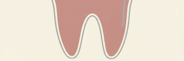 A flat vector illustration of a stylized tooth outline with a small boarding pass or travel icon, muted grey and warm tones.