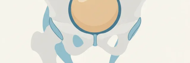 A simple cross-section diagram of a hip joint with a prosthetic implant, flat vector illustration.