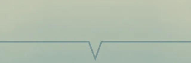 A single heartbeat line on a monitor that dips sharply then steadies, drawn in muted tones, flat vector illustration.